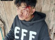 Tim Media Investigasi Datangi Rumah Korban Dugaan Penganiayaan Anak di Bawah Umur