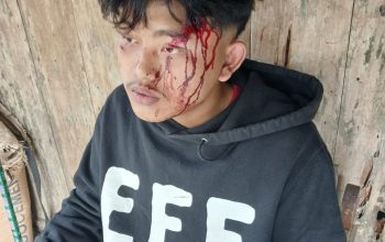 Tim Media Investigasi Datangi Rumah Korban Dugaan Penganiayaan Anak di Bawah Umur