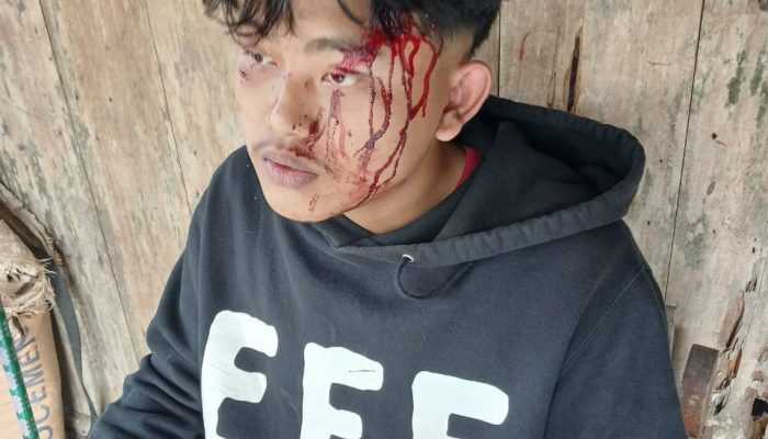 Tim Media Investigasi Datangi Rumah Korban Dugaan Penganiayaan Anak di Bawah Umur